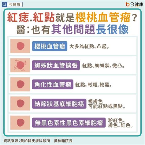 身體很多痣|皮膚長痣、長斑是皮膚癌前兆？皮膚癌初期4大症狀快。